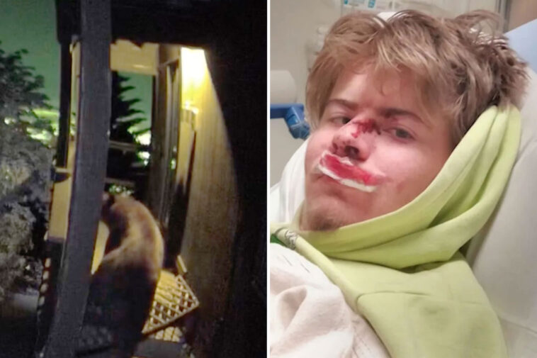 california-teen,-19,-left-with-horrific-injuries-after-being-mauled-by-bear-inside-his-home-—-as-video-released