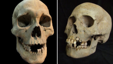 scientists-discover-oldest-known-evidence-of-the-plague-with-5,500-year-old-teeth