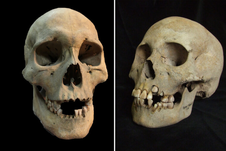scientists-discover-oldest-known-evidence-of-the-plague-with-5,500-year-old-teeth
