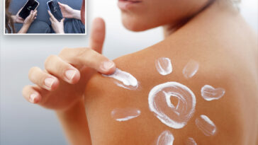 bizarre-videos-claiming-sunburns-‘aren’t-dangerous’-are-flooding-tiktok,-study-warns