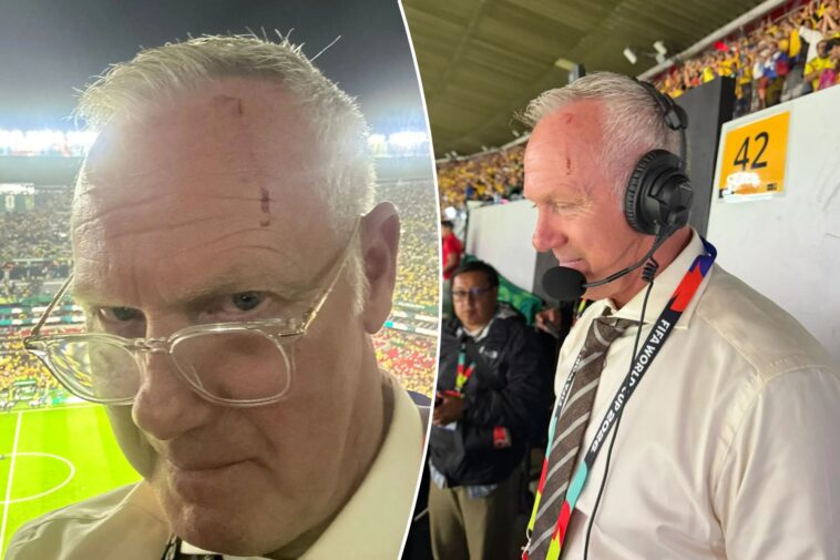fox-sports’-warren-barton-bloodied-after-being-hit-by-‘sharp’-object-in-scary-world-cup-scene