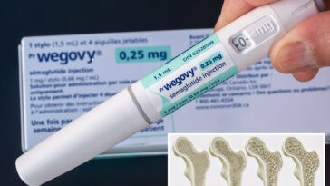 ozempic-and-wegovy-may-strengthen-bones-in-type-2-diabetes-patients,-study-finds