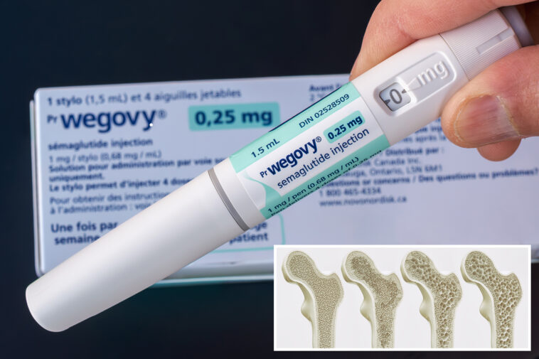 ozempic-and-wegovy-may-strengthen-bones-in-type-2-diabetes-patients,-study-finds
