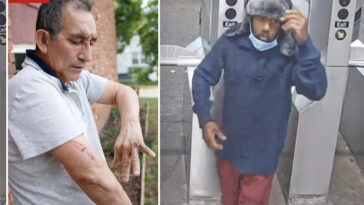 suspect-in-nyc-subway-shove-held-without-bail-as-prosecutors-say-victim-needed-4-staples-to-close-head-wound