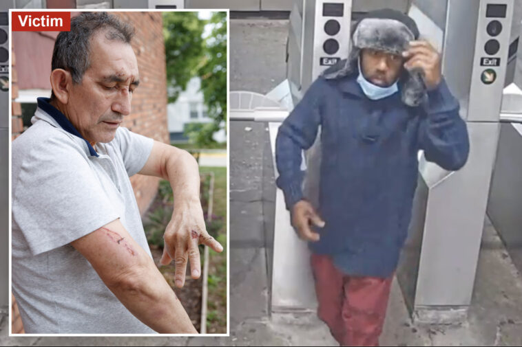 suspect-in-nyc-subway-shove-held-without-bail-as-prosecutors-say-victim-needed-4-staples-to-close-head-wound