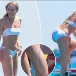 bikini-clad-lindsey-vonn-shows-off-her-injured-leg-on-yacht-four-months-after-horror-crash
