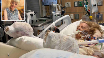 82-year-old-mother-suffers-severe-burns-‘down-to-the-muscle-and-the-bone’-after-falling-asleep-by-pool