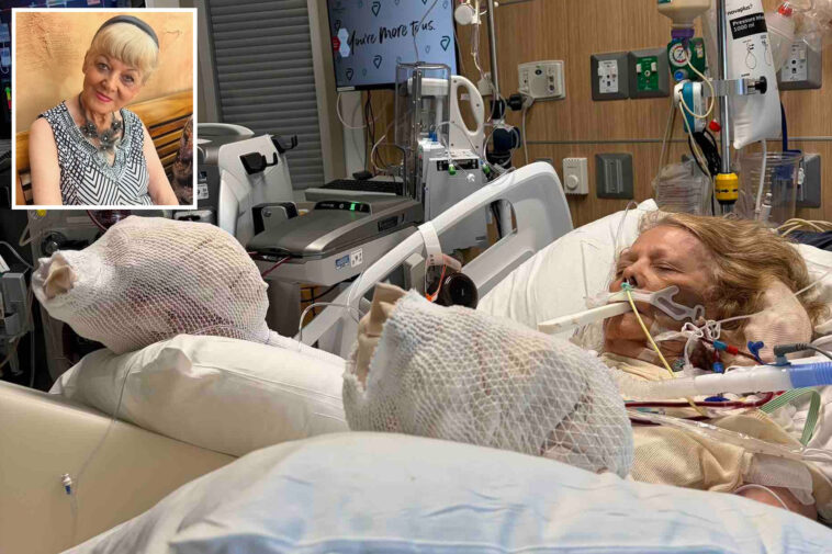 82-year-old-mother-suffers-severe-burns-‘down-to-the-muscle-and-the-bone’-after-falling-asleep-by-pool