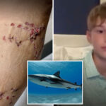 boy,-12,-saved-by-older-brother-after-shark-attack-on-bahamas-family-vacation