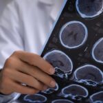 doctors-thought-man-had-brain-cancer-—-they-found-live-tapeworms-instead