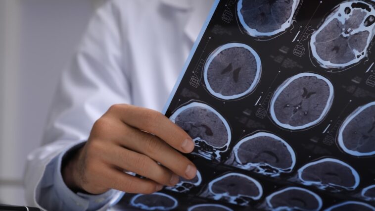 doctors-thought-man-had-brain-cancer-—-they-found-live-tapeworms-instead