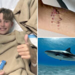 boy,-12,-believed-he-was-going-‘to-die’-after-grisly-shark-attack-on-bahamas-family-vacation