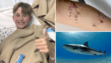 boy,-12,-believed-he-was-going-‘to-die’-after-grisly-shark-attack-on-bahamas-family-vacation