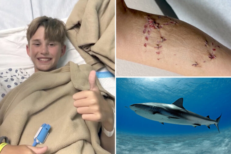 boy,-12,-believed-he-was-going-‘to-die’-after-grisly-shark-attack-on-bahamas-family-vacation