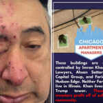 chicago-renter-woke-up-to-rats-gnawing-on-his-face-after-complaining-about-infestation-to-landlord-for-months