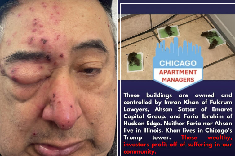 chicago-renter-woke-up-to-rats-gnawing-on-his-face-after-complaining-about-infestation-to-landlord-for-months