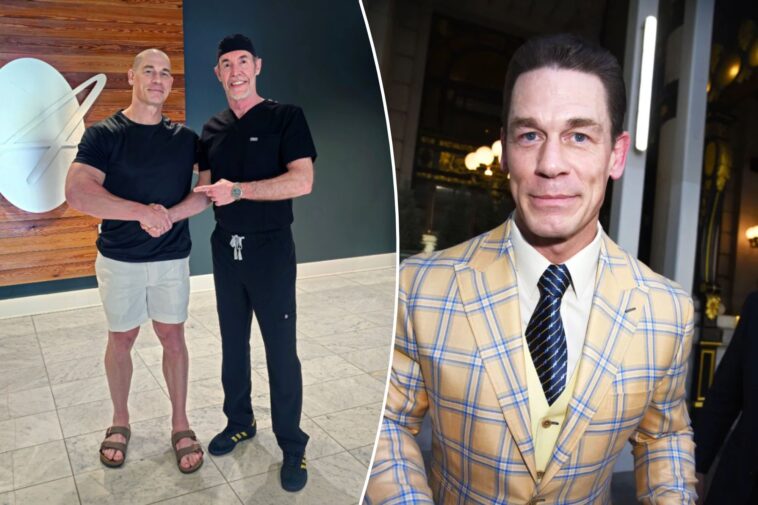 john-cena-posts-shocking-bald-photo-as-part-of-hair-transplants
