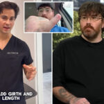 owner-of-world’s-smallest-penis-gets-shot-at-personal-growth-from-plastic-surgeon