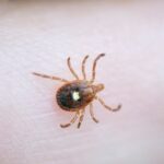 record-high-cases-of-rare-tick-borne-virus-reported-across-us.