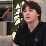 minnesota-teen-loses-part-of-bowel-after-consuming-grill-brush-bristle-stuck-inside-burger:-‘so-much-pain’