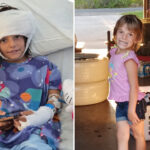 california-girl,-7,-left-‘fighting-for-her-life’-after-pack-of-dogs-rip-off-scalp,-shred-legs