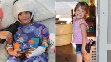 california-girl,-7,-left-‘fighting-for-her-life’-after-pack-of-dogs-rip-off-scalp,-shred-legs