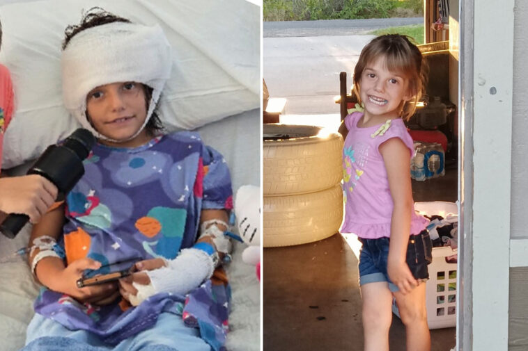 california-girl,-7,-left-‘fighting-for-her-life’-after-pack-of-dogs-rip-off-scalp,-shred-legs