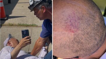 nyc-council-staffer-allegedly-assaulted-by-contractor-at-controversial-battery-storage-site