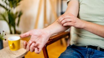 why-scratching-a-mosquito-bite-makes-it-so-much-worse,-according-to-science