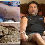 grandfather-rushed-to-hospital-after-being-biten-by-highly-venomous-rattlesnake-three-times