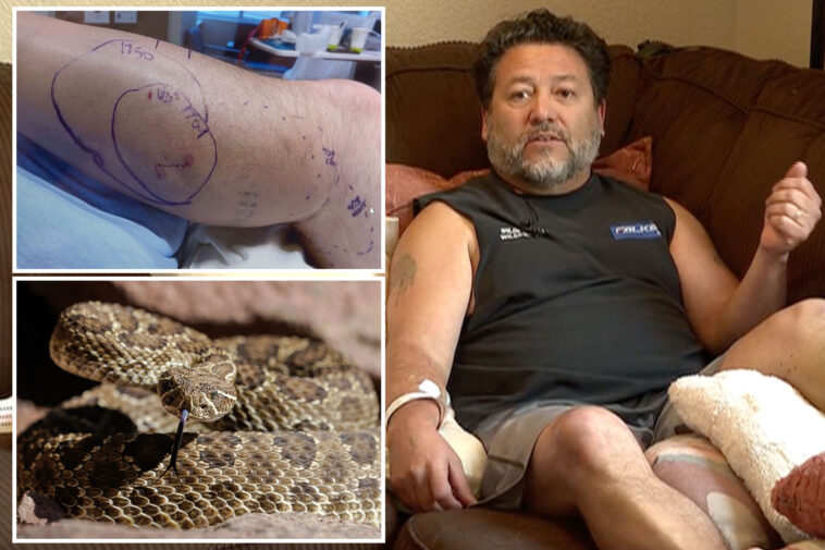 grandfather-rushed-to-hospital-after-being-biten-by-highly-venomous-rattlesnake-three-times