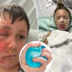 doctors-issue-warning-over-massively-popular-toy-that’s-hospitalizing-children-with-excruciating-injuries