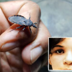 case-of-deadly-‘kissing-bug’-found-in-california-—-and-sufferers-may-not-even-know-they-have-it