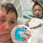 doctors-issue-warnings-as-popular-toy-inflicts-horrific-injuries-on-kids