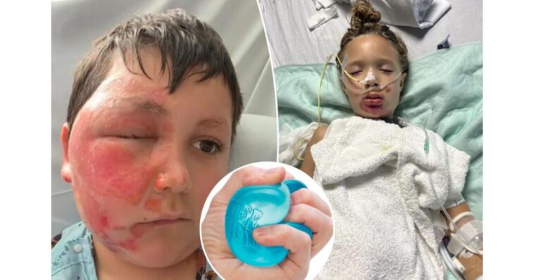 doctors-issue-warnings-as-popular-toy-inflicts-horrific-injuries-on-kids
