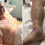 hospital-runs-out-of-anti-venom-in-desperate-attempt-to-save-life-of-father-of-three
