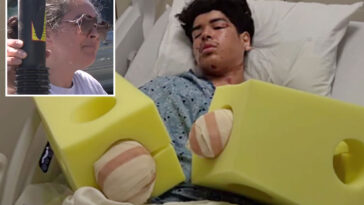 california-mom-goes-ballistic-after-teen-son’s-hands-are-blown-to-pieces-after-near-deadly-mistake
