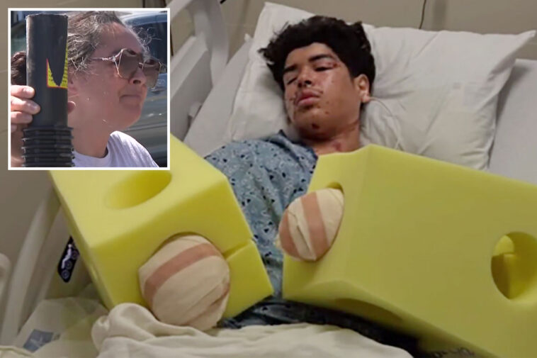 california-mom-goes-ballistic-after-teen-son’s-hands-are-blown-to-pieces-after-near-deadly-mistake