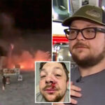 firefighter-father-struck-by-lightning-in-alabama-exactly-one-year-after-firework-exploded-in-his-face:-‘lucky-to-be-here’