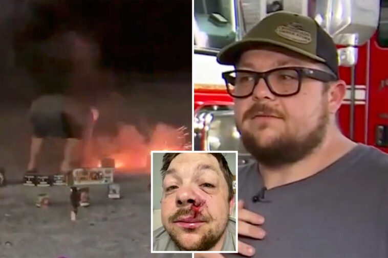 firefighter-father-struck-by-lightning-in-alabama-exactly-one-year-after-firework-exploded-in-his-face:-‘lucky-to-be-here’
