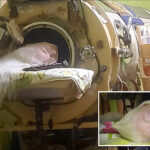 oklahoma-woman-martha-lillard,-last-us-polio-patient-using-iron-lung,-dead-at-78