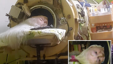 oklahoma-woman-martha-lillard,-last-us-polio-patient-using-iron-lung,-dead-at-78