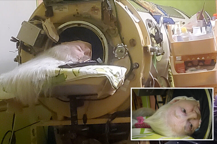 oklahoma-woman-martha-lillard,-last-us-polio-patient-using-iron-lung,-dead-at-78