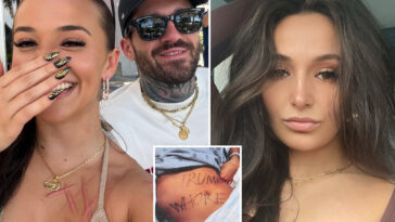 ex-nj-gop-aide-accused-of-staging-slashing-attack-shows-off-horrific-scars-—-and-mystery-man-—-in-new-snap