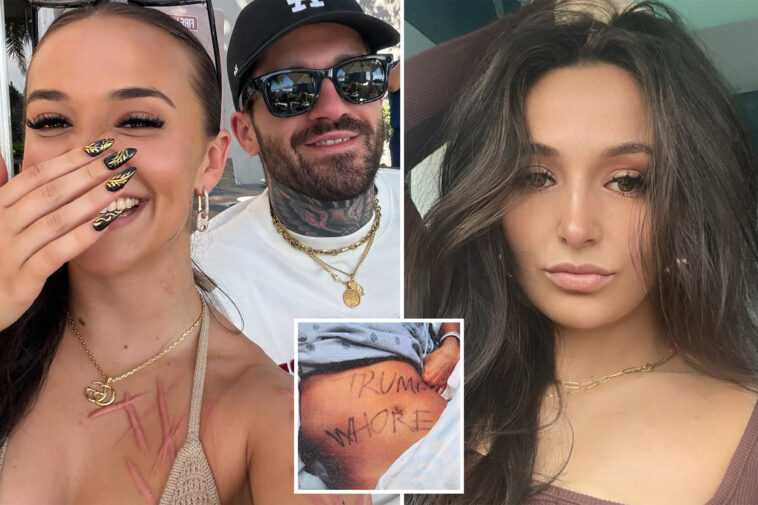 ex-nj-gop-aide-accused-of-staging-slashing-attack-shows-off-horrific-scars-—-and-mystery-man-—-in-new-snap