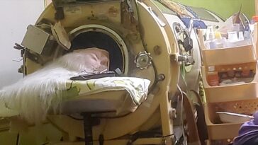 last-american-to-use-an-iron-lung-dies-at-78-years-old-after-childhood-polio-diagnosis