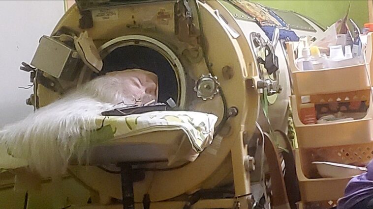 last-american-to-use-an-iron-lung-dies-at-78-years-old-after-childhood-polio-diagnosis