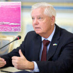 heart-condition-tied-to-lindsey-graham’s-death-can-strike-without-warning:-experts