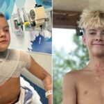 microwaved-squishy-toy-explodes-onto-boy’s-face-and-chest-amid-viral-trend,-causing-horrific-burns