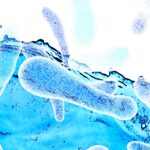 latest-nyc-legionnaires’-disease-outbreak-rises-to-59-cases-—-with-bacteria-now-detected-for-first-time-across-park,-at-posh-uws-building
